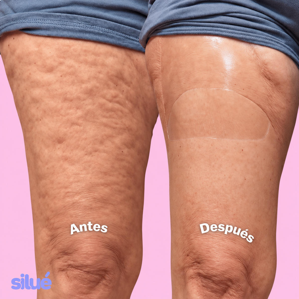 Silué™ Piernas y Glúteos Tonificados