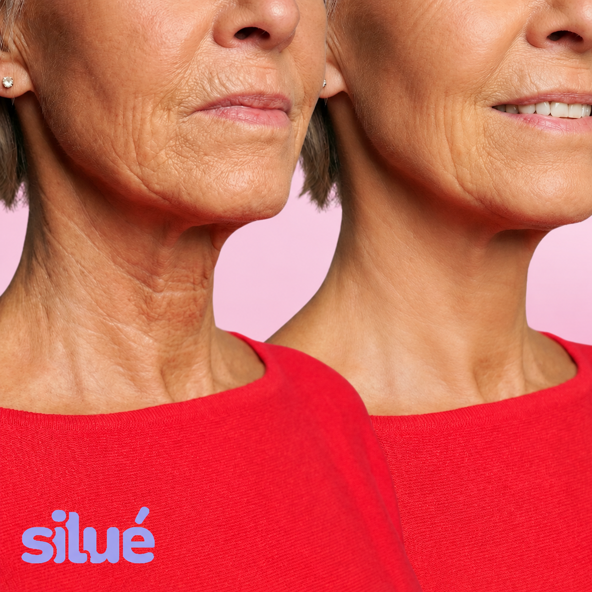 Silué™ Cuello Tonificado